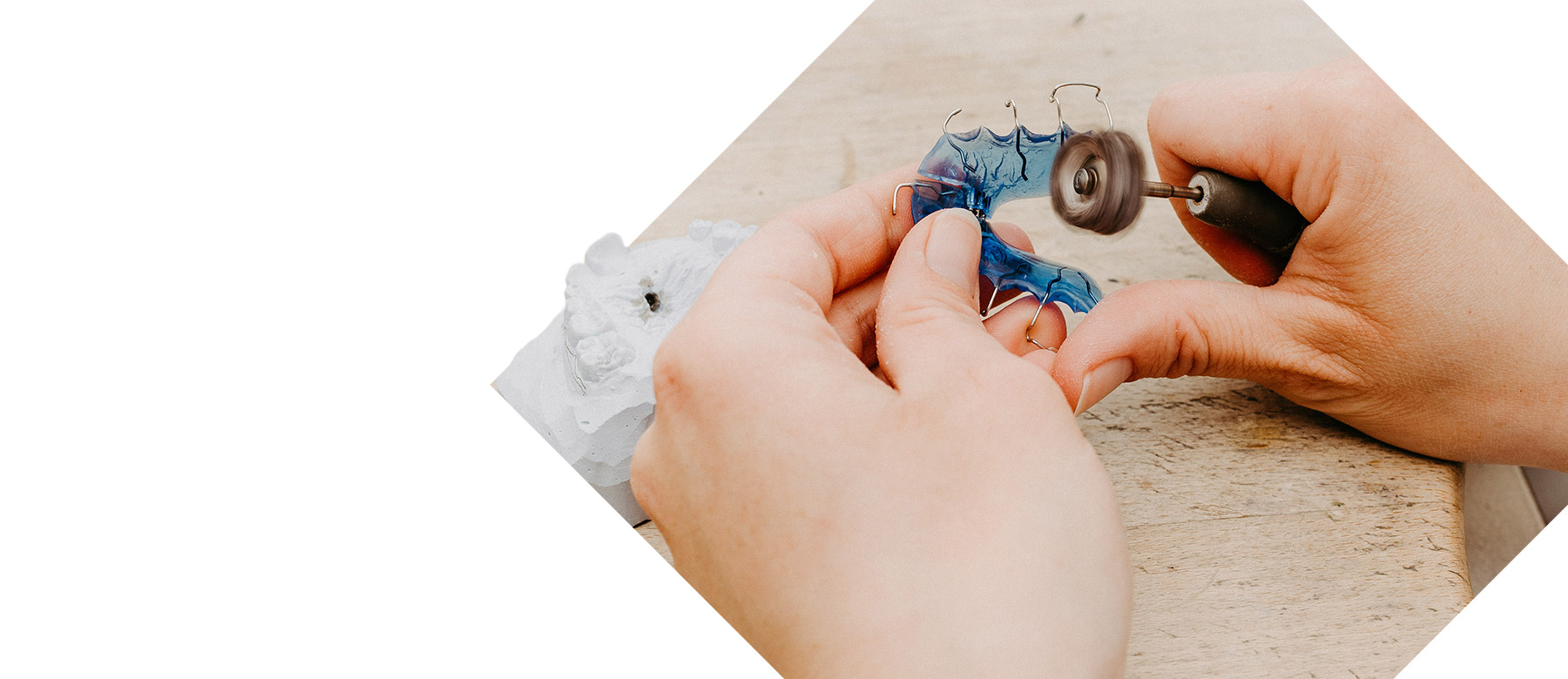 Herausnehmbarer Zahnersatz für Kinder in Bearbeitung in der KFO Euskirchen